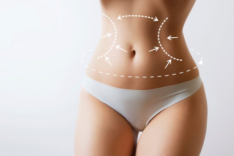What Is Lipo 360