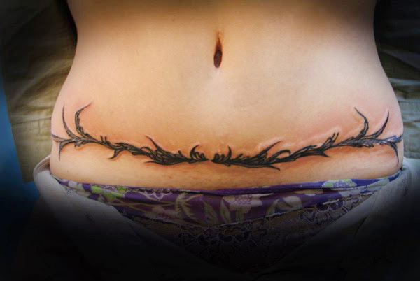 Liposuction Scar Tattoo