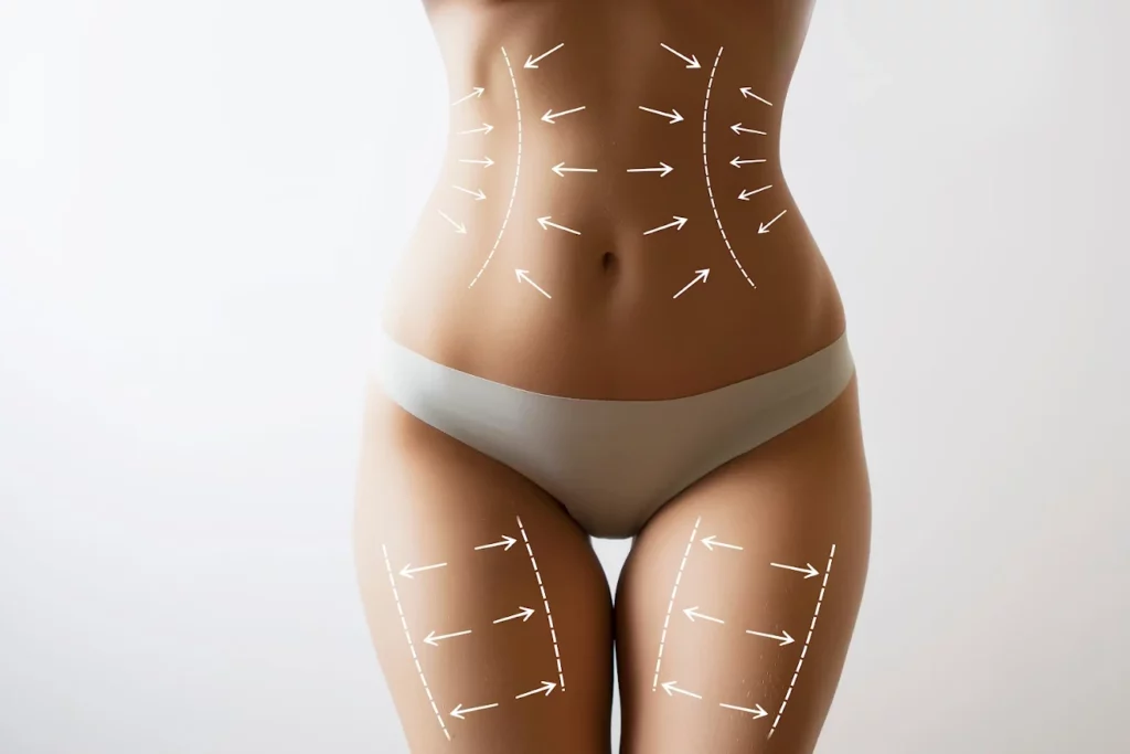 Woman in white underwear marked by white arrows on stomach and legs