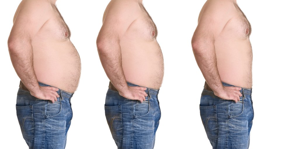 Vaser lipo for men Before and After Photo